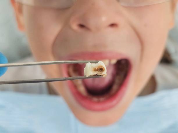 Best Teeth Whitening  in Commerce, CA